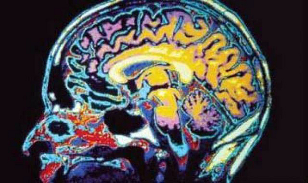 brain injury awareness month